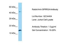 SPRR2A Rabbit anti-Human, Polyclonal, Novus Biologicals 0.1 mL | Buy Online | Novus Biologicals | Fisher Scientific